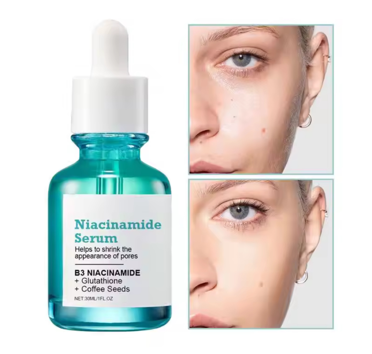 Ser cu Niacinamide si Glutation, pentru luminozitate si pete pigmentare - Extensii de par București